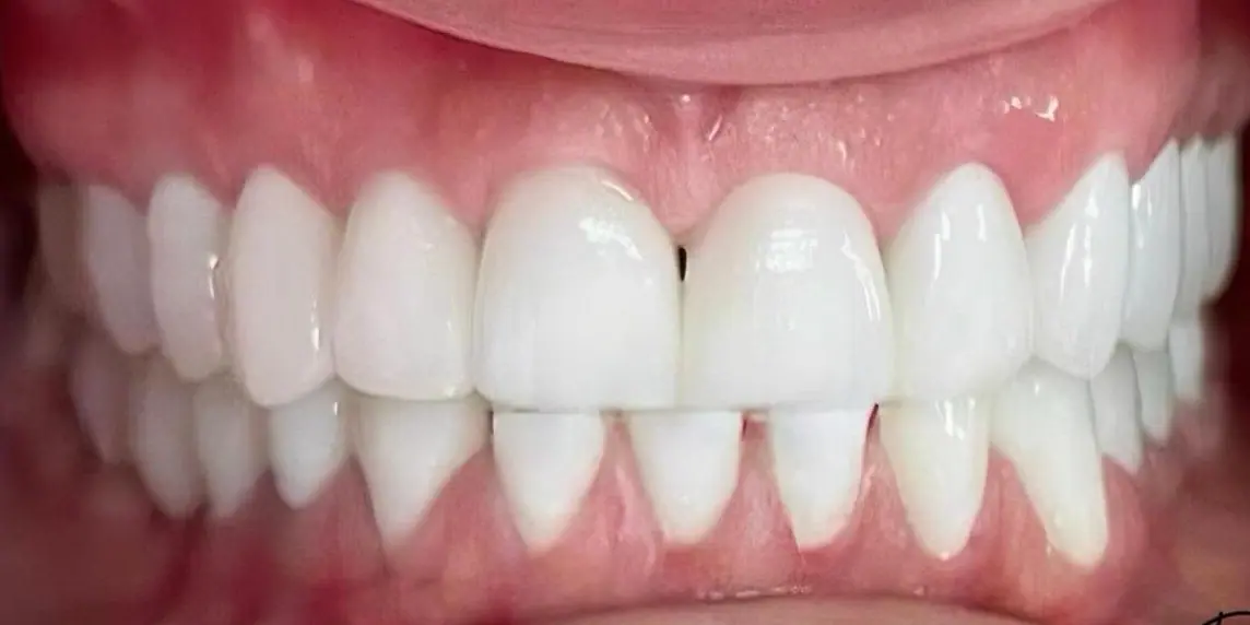 After: Aesthetics and function restored