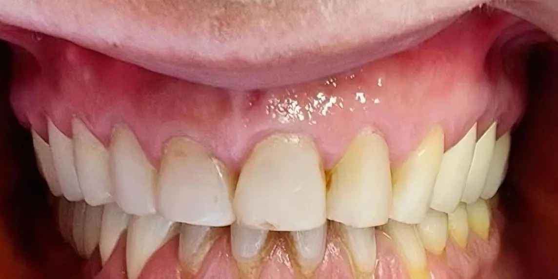 Before: Aesthetics and function restored